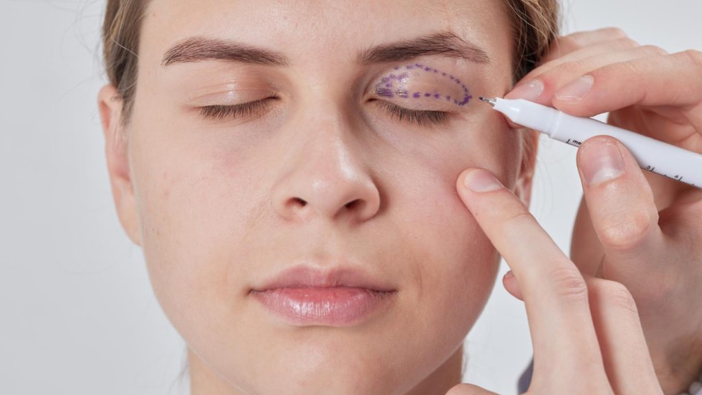 Comment choisir son chirurgien pour une blépharoplastie à Nantes ?